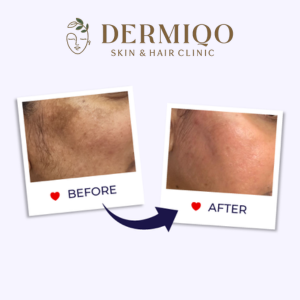 Skin and Hair Clinic in Rohini