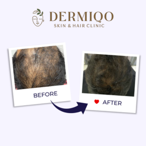 Best Skin Clinic in Delhi